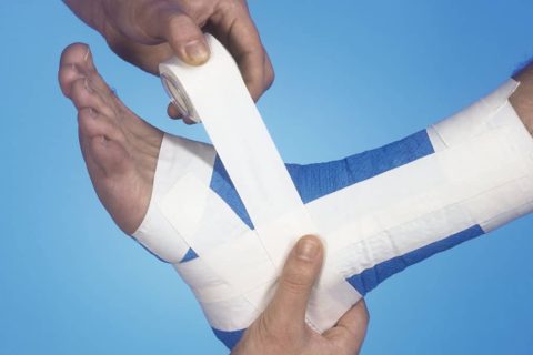 BENDAGGI FUNZIONALI